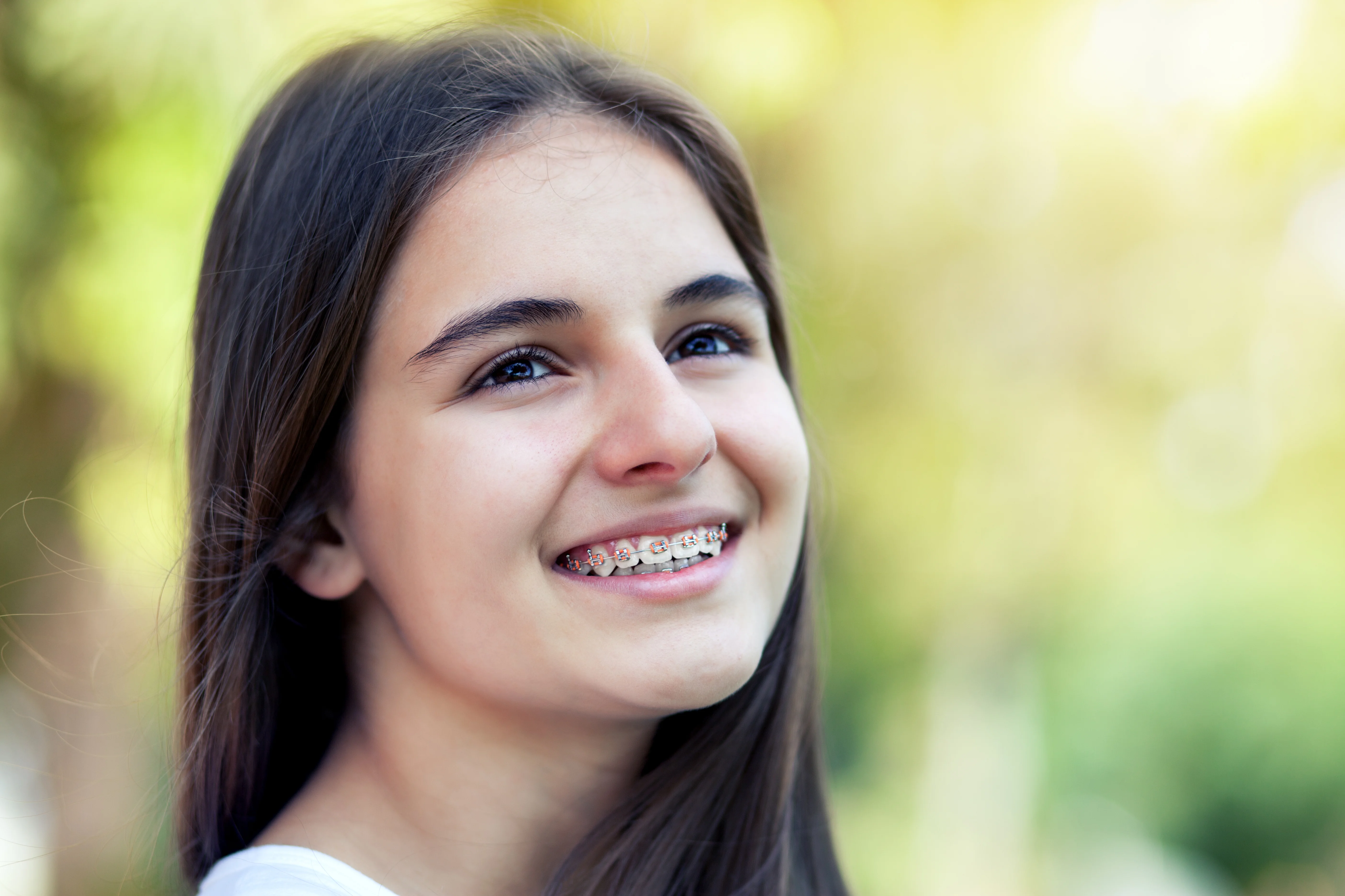 Are White Braces More Expensive